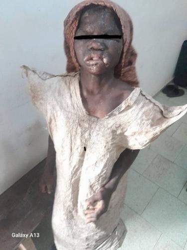 Côte d’Ivoire : Maltraitance d’enfant / Une fillette arrachée à l’enfer par la Police